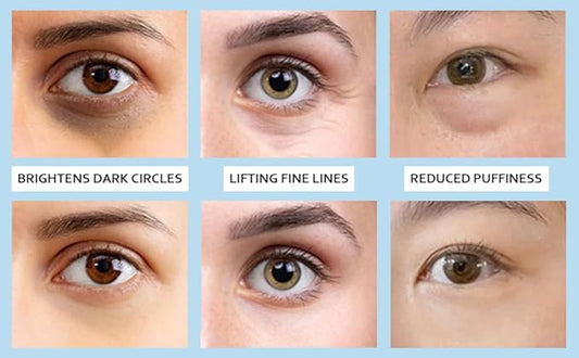 5% Caffeine Eye Serum, Under Eye Roller Cream for Dark Circles and Puffiness with 360°Massage Ball Reduce Wrinkles and Fine Lines,Bags Under Eyes,15ML