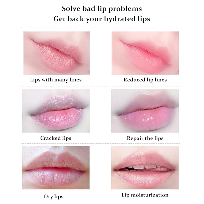 20Pcs Lip Mask,Pink Moisturizing Plumping Lip Masks Overnight,Pink Lip Mask Gel Treatment Lip Masks for Dry Lips Plump Lip Collagen Overnight Sleeping Lip Mask Pads Patches(Pink)