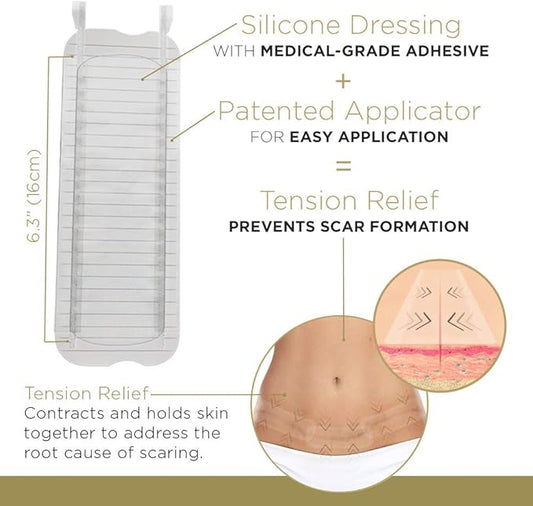 Embrace Active Scar Defense for New Tummy Tuck Scars, FDA-Cleared Extra-Large Silicone Scar Sheets, 30 Day Supply