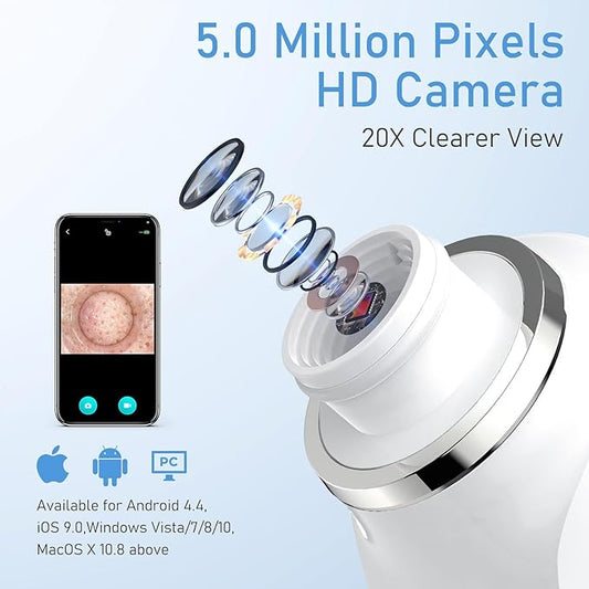 Facial Pore Blackhead Remover Vacuum, 1080P Camera Blackhead Remover, 20x Zoom, 8 LEDs & 3 Suction Modes, 800mAh Battery & USB - 6 Heads Pore Cleaner Kit for Women&Men(Orange)