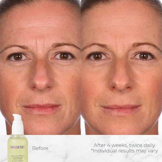 NassifMD Hydro-Screen Hydrating Serum with Hyaluronic Acid & Ceramides – Lightweight, Fast-Absorbing Formula for Smooth, Plump, Moisturized Skin – Ideal for Dry or Sensitive Skin