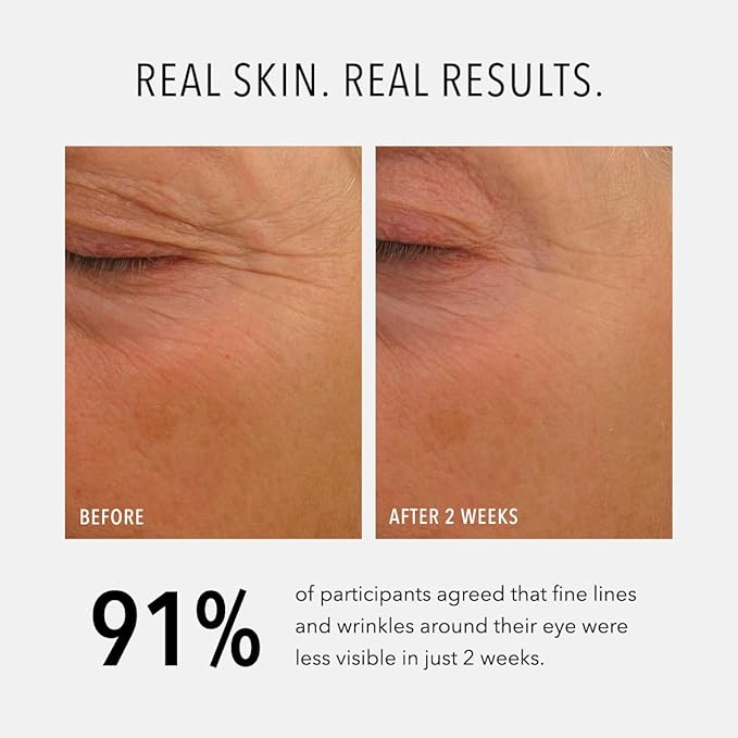 HydroPeptide Eye Authority, Brightens and Helps Restore Radiance to Tired Looking Eyes, 0.5 Ounce