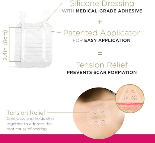 Embrace Active Scar Defense for New Scars, FDA-Cleared Silicone Scar Sheets, 2.4 Inch, Medium, 60 Day Supply (Recommended Treatment)