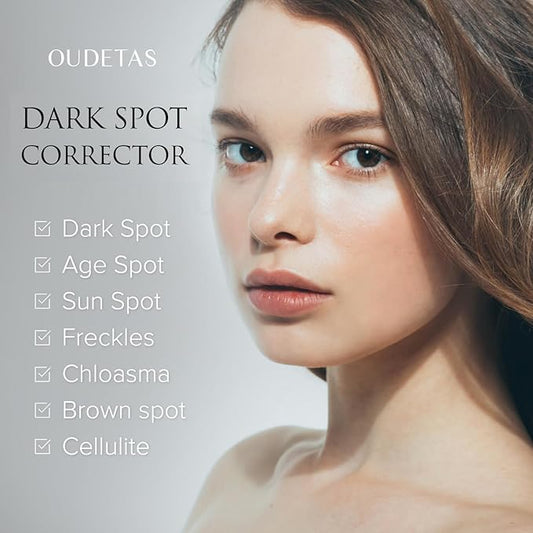 Dark Spot Remover for Face: Remove Sun & Age Spot Corrector – Melasma & Hyperpigmentation Brightening Serum for Body(Hand Leg Arm) – Brown Skin and Freckles Removal Treatment with Roller 15ml