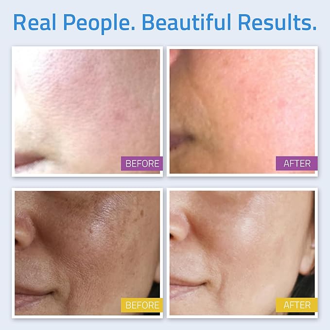 YEOUTH Skin Care Set: Retinol Serum with Hyaluronic Acid, Vitamin C & Super Face Serum, Cleanser, Toner, Eye Gel, Neck Cream, Face Cream 8-Piece Skincare Kit For Women