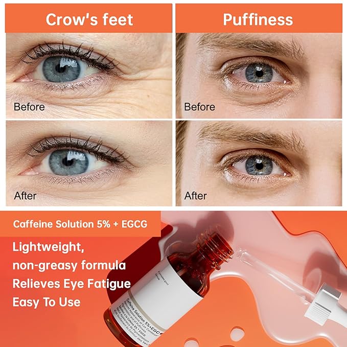 The Caffeine Solution 5% + EGCG,Reduces Appearance of Eye Contour Pigmentation and Puffiness,Under Eye Serum (30ml) Caffeine For Face Moisturizing Serum (2)