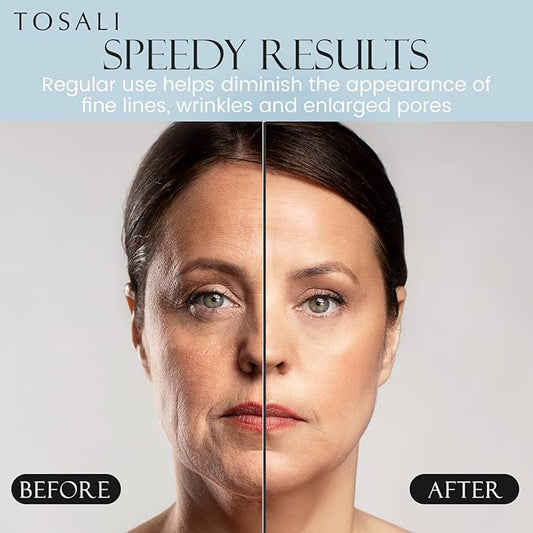 Anti Aging Daily Peeling Face Exfoliator – Peeling Gel with Hyaluronic Acid, Lactic Acid & Vitamin E, Gentle Exfoliating Gel for All Skin Types, Skin Care for Women, 6.8 Oz