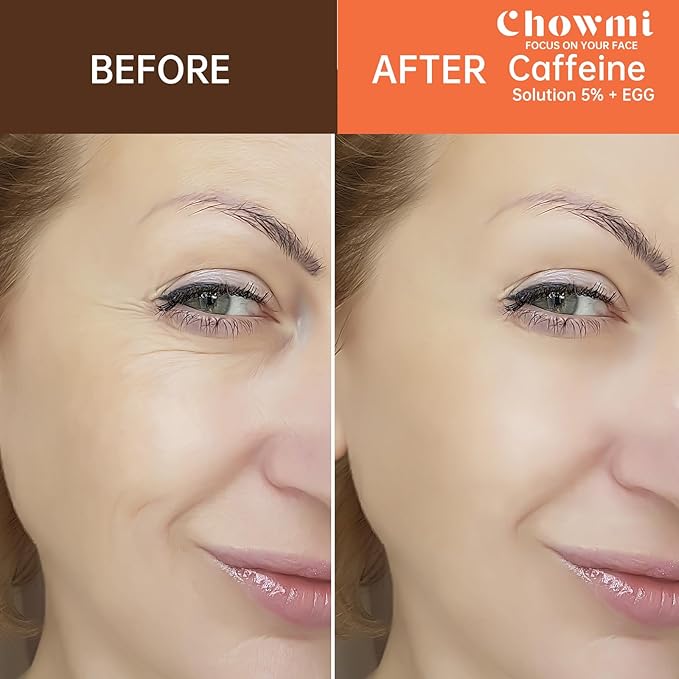 The Caffeine Solution 5% + EGCG,Reduces Appearance of Eye Contour Pigmentation and Puffiness,Under Eye Serum (30ml) Caffeine For Face Moisturizing Serum (2)
