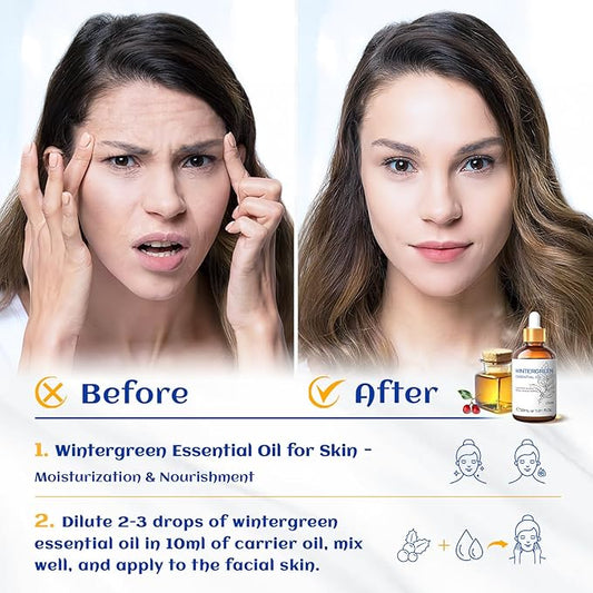 HIQILI 1 Fl Oz Wintergreen Essential Oil, 100% Pure Natural for Skin, Diffuser - 30ml