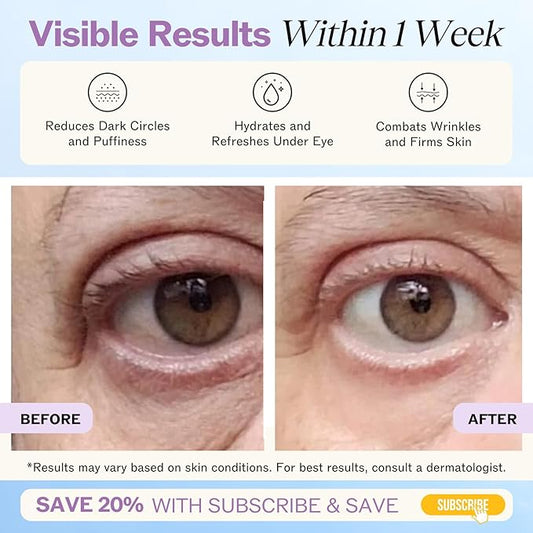 LilyAna Naturals Eye Cream for Dark Circles and Puffiness, Anti Aging Under Eye Cream for Wrinkles and Bags helps Improve Dryness; for Sensitive Skin (Bottle, 1.0 Ounce (Pack of 1))