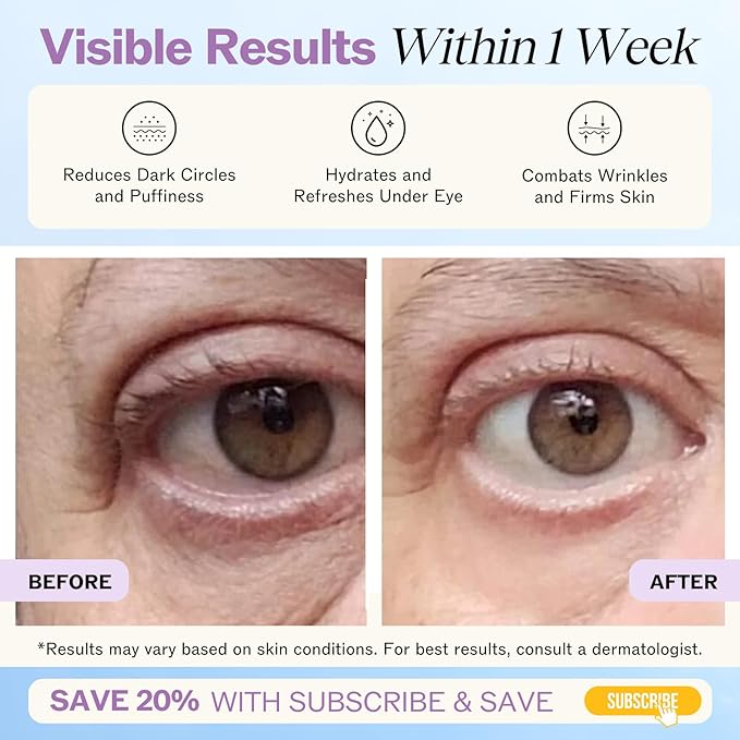 LilyAna Naturals Eye Cream for Dark Circles and Puffiness, Under Eye Cream for Wrinkles and Bags, Anti Aging - helps Improve Dryness; for Sensitive Skin - 1.7 oz - Made in USA