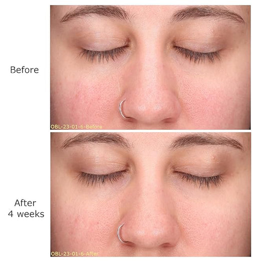 Daily Moisturizing Collection, Activator with Clarifying Azelaic Acid+ Concentrate Starter, Brightening, Firming Clarity, Suitable for Sensitive Skin, Gift Bundle/Starter Kit