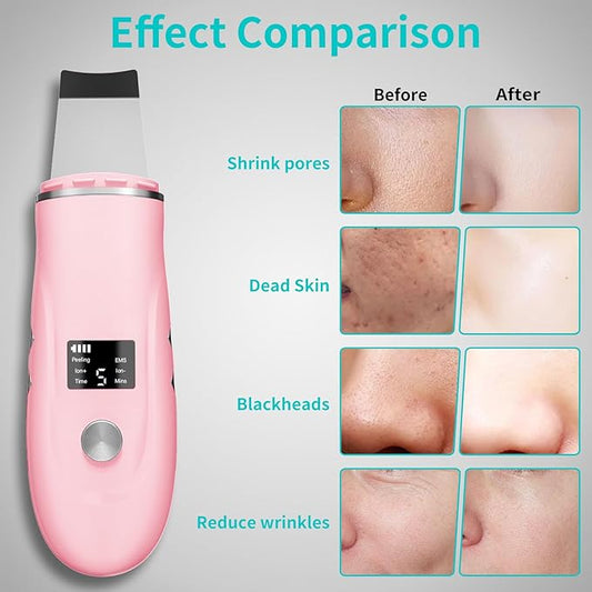 Skin Scrubber Facial Spatula - 4-in-1 Deep Cleansing Tool for Pore Extraction, Fast Charging Dock Blackhead Remover Face Spatula for Facial Skincare Women Gift (Pink)