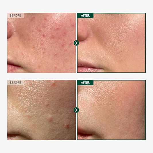 Madagascar Centella 86% Ampoule with 860,048ppm Centella Asiatica, Soothing, Calming, Facial Serum for face, for All Skin Types, Korean Skin Care, 100ml, 3.38 fl.oz.