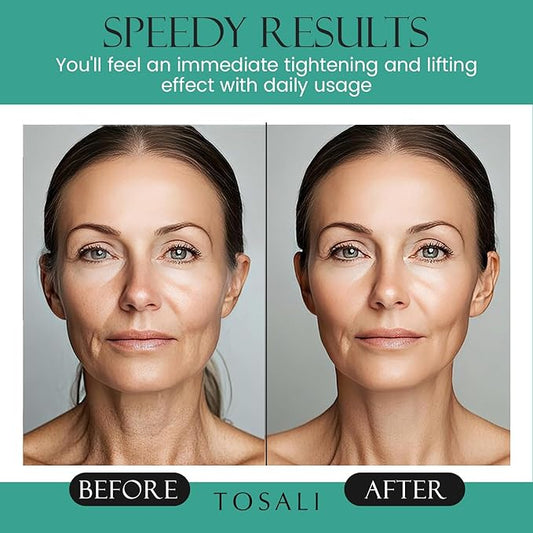 Anti Aging Face Cream for Women, 1.7 oz - Niacinamide Cream, Hydrating Face Moisturizer with Multivitamins - Day & Night Cream for Face with Anti Aging Effect, Skin Care for All Skin Types