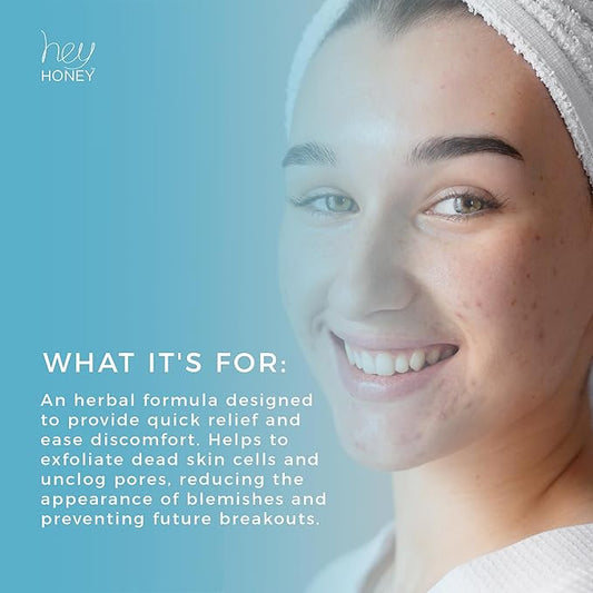 Hey Honey Skincare Be Clear Acne Routine | Clarifying Overnight Treatment | Propolis & Herbal Cream for Blemishes & Acne-Prone Skin | Immidiate Soothing Relief | 1.9 Oz