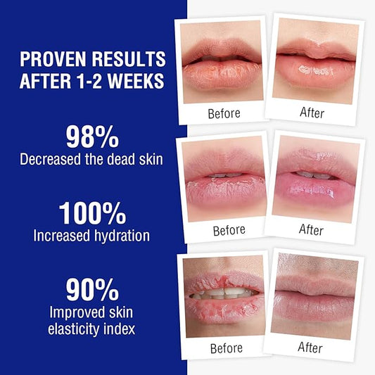 Lip Balm Treatment with Beeswax, Peppermint Oil,Natural Formula Lip Balm with Vitamin E & C Lips Daily Conditioning 24 hrs Long-lasting Moisture, Gentle Exfoliation Prevent Dryness & Chapping