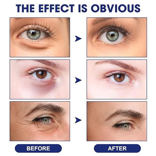 Anti Wrinkle Essence, Glozie Eye Serum, Glozie Instant Eye Lift Eye Cream, Anti Wrinkle Serum, Eye Cream For Wrinkles, Instant Anti-Aging Firm Eye Temporary Eye Tightener, Permanent Anti-Aging Cream