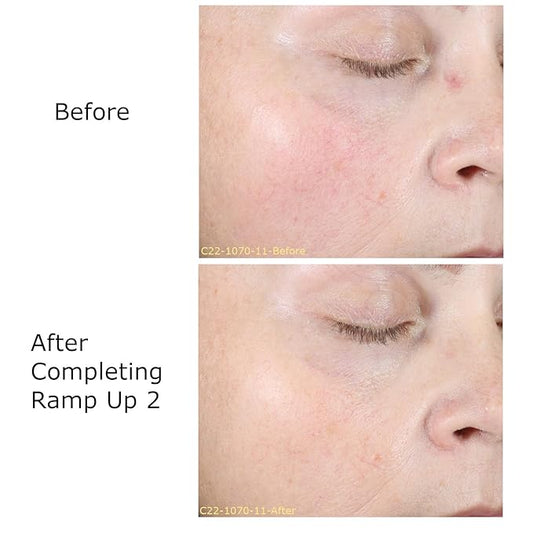 Hydrate & Soothe Beauty Collection Gift Bundle / Starter Kit, Activator with 0.05% Retinol Cream, Ramp-Up Regimen 2 & RHR Overnight Mask, Skin Care Routine, For All Skin Type