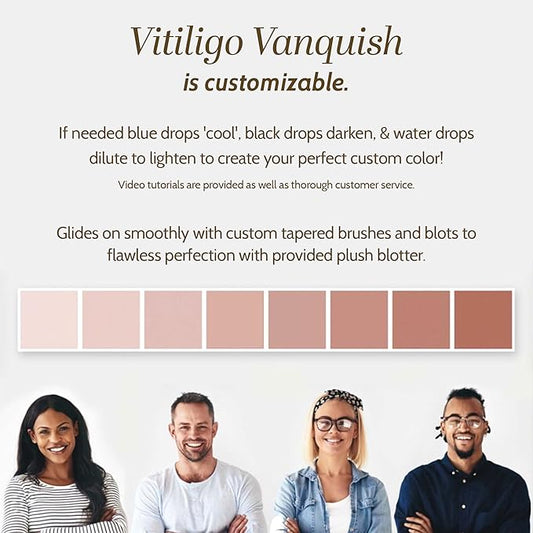 Vitiligo Vanquish Cosmetic Camouflage Kit by Fake Bake Liquid Concealer, Long Lasting Natural Color Customization Eliminates Appearance of Skin Depigmentation For Women & Men - Cover Lasts For Days