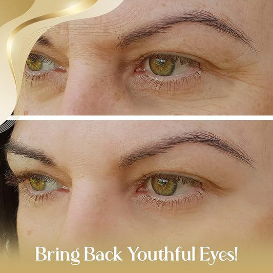 OROGOLD 24K Intensive Eye Serum for Wrinkles, Puffiness - Anti Aging Serum For Youthful Looking Skin - Under Eye Skin Softening Serum - 50 ml. / 1.76 fl. oz.