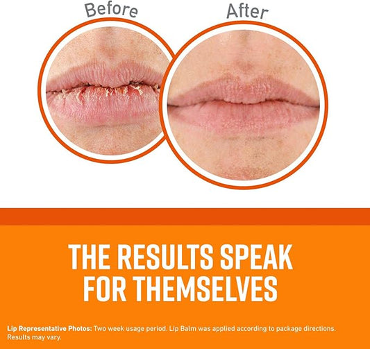 O'Keeffe's Unscented Lip Repair Lip Balm for Dry, Cracked Lips, Stick, (Pack of 6)