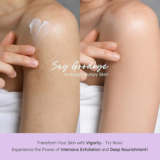 Vigority Keratosis Pilaris Treatment Cream with Lactic Acid – KP Body Bump Exfoliating Moisturizer for Rough, Bumpy, Dry & Flakey Skin, Strawberry Legs – 5.1 Oz