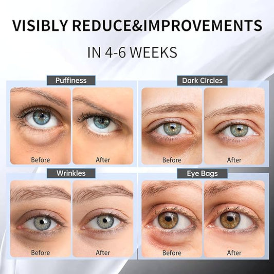 Advanced Snail Hydrogel Eye Patch 60 Patches, Gel Serum Mask, Undereye Treament, Fine Lined, Puffy Eyes, Refresh, Hydrate, Paraben free, Phthalates free, Skincare