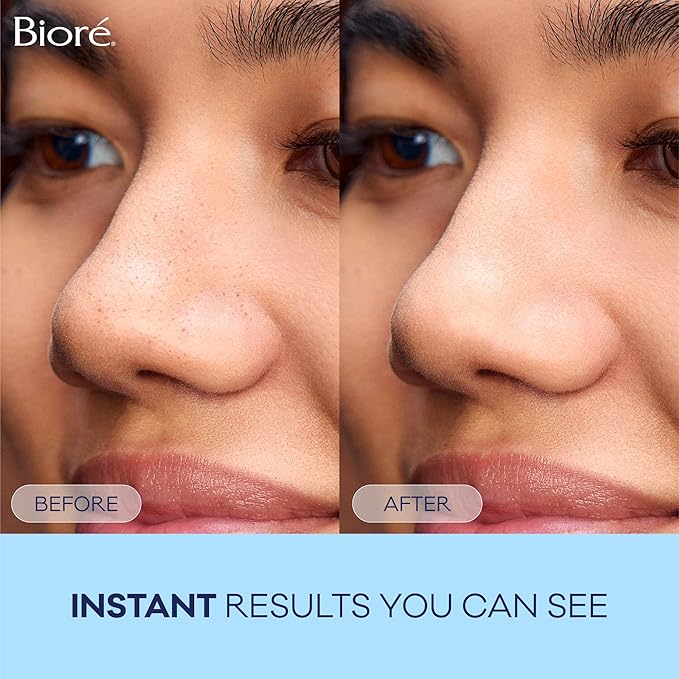 Bioré Original Blackhead Remover Strips, Deep Cleansing Nose Strips With Instant Pore Unclogging, Features C-Bond Technology, Oil-Free, Non-Comedogenic Use, 14 Count, Pack of 4