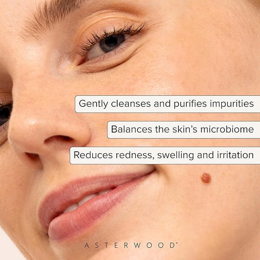 Asterwood Hypochlorous Acid Spray for Face - Targets Acne, Redness, Irritation - Multi-Purpose Skin Repair - Antibacterial, Antimicrobial - After Gym/Post-Workout Facial Mist - 4 Fl Oz