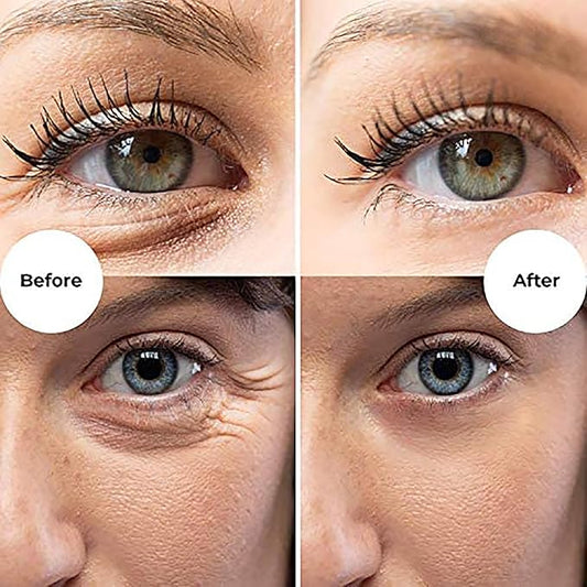 Gle Vitamin C Eye Serum for Dark Circles, Eye Wrinkles, Redness and Puffy Eyes | Anti-Aging Treatment with Caffeine, Vitamin C Hyaluronic Acid | Hydrating & Brightening Scent-Free | (Pack of 2)