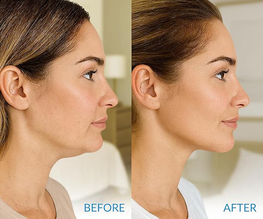 Stylia MaxiLift V-Line Lifting Collagen Face Mask – Enhanced Double Chin Reducer – Jawline Shaper Face Lifting Masks – Firming Neck Lift Collagen Mask – Chin Strap for Sleeping – Hyaluronic, Aloe 5PC