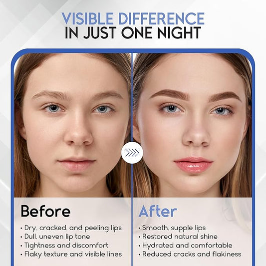 Lip Mask Overnight with Hyaluronic Acid & Collagen, Lip Sleeping Mask for Dry Cracked Lips, Moisturizing, Hydrating, Exfoliating Night Treatment for Lip Care (Berry)