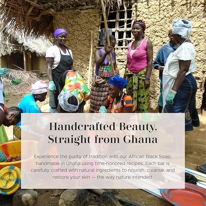 era of nature Organic Shea, Mango & Cocoa Body Butter – Raw, Unrefined, 100% Natural – Perfect Base for DIY Skincare, Body Butters, Lotions, Soaps & Lip Balms – Essential for Homemade Creations – 8oz