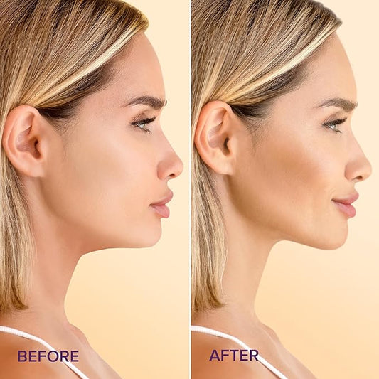 MAREE V Line Lifting Mask with 24K Gold – Deep Collagen Face Mask for Women – Jawline Shaper Mask with Retinol & Hyaluronic Acid – Neck Tightening & Firming - Double Chin Strap for Face Lift