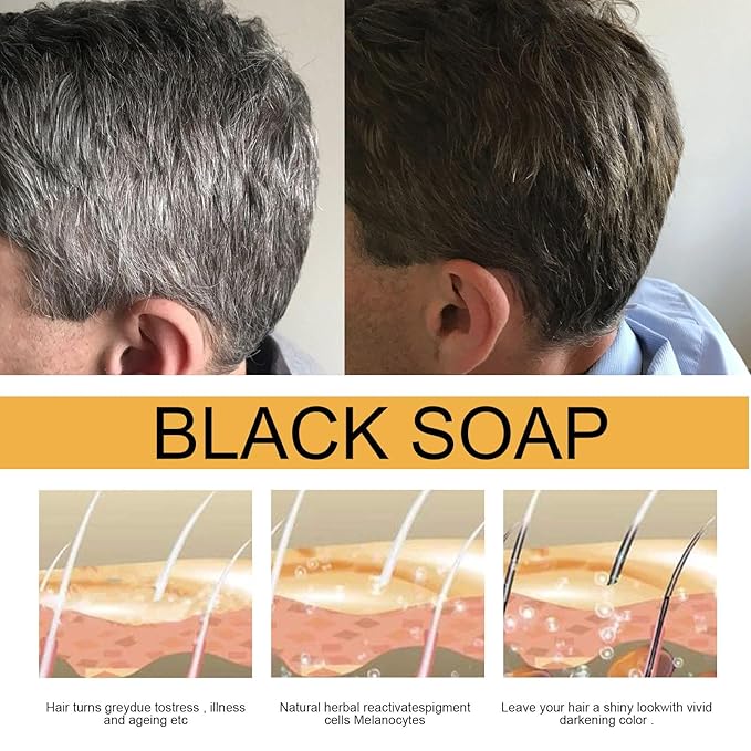 3PCS Hira Darkening Polygonum Shampoo Bar for Gray, Thinning Hair and Hair Growth (he shouwu) - Soap Bar