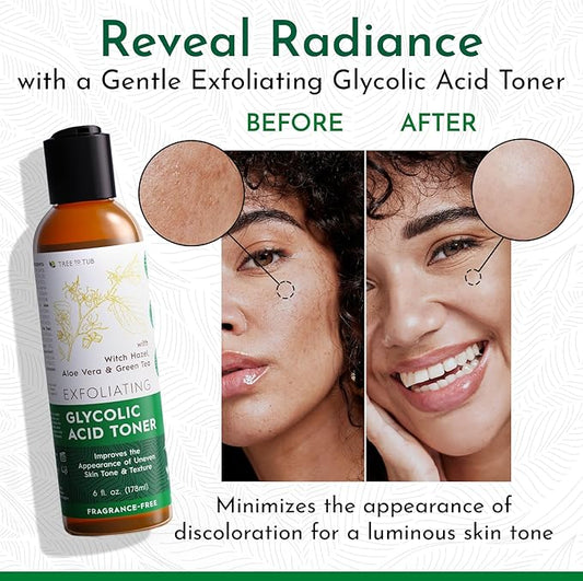 Tree To Tub Glycolic Acid Toner for Face w/Witch Hazel & Hydrating Aloe Vera for Smooth Skin - Minimizes Appearance of Fine Lines & Brightens - Vegan Exfoliating Toner for Women & Men