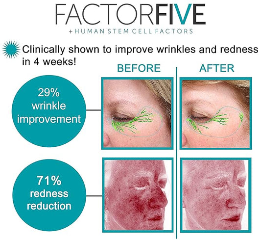 Age Defying Cream with Stem Cell Growth Factors for Anti-Wrinkle, Collagen Boost, and Acne Scarring Repair, Large Size, 1fl oz/30ml