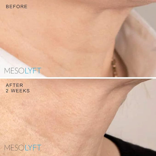 Anti-Aging Serum with Neck & Eyes Combo Skincare Face Serum Reduce Signs of Aging Roller for Face An Effective Treatment for Neck and Eyes
