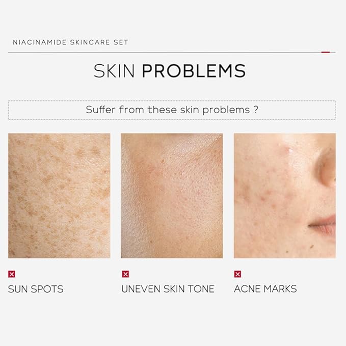 Niacinamide Skincare Set: 4pcs Beauty Kit with Cleanser, Toner, Serum, & Facial Cream - Hydrates & Evens Skin Tone - TSA-Friendly Travel Sizes, Perfect Gift for Women, Moms, & Teens