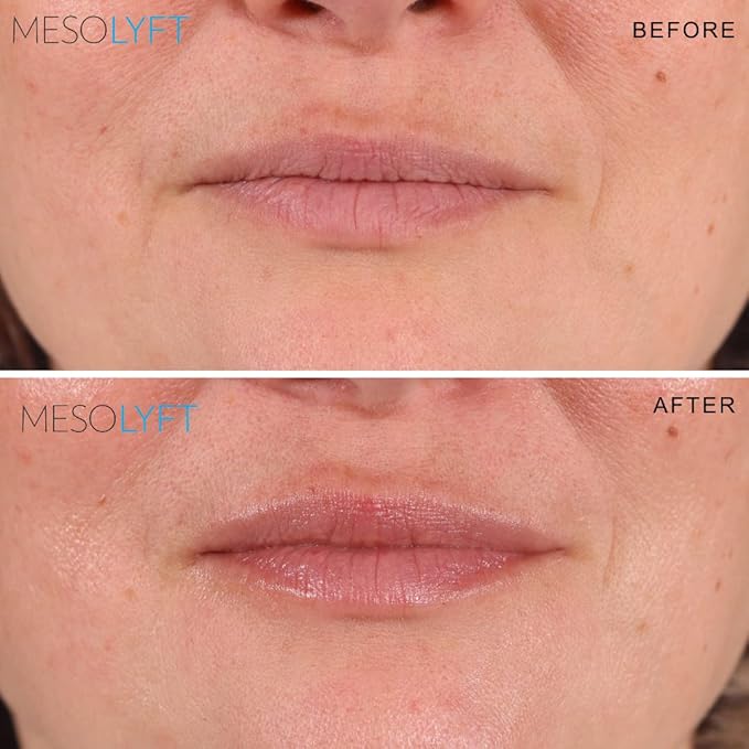 Neck & Lip Plumper Combo with Roller to Instantly Plump Lips & Neck - Neck Serum Improves the Neck Skin - Plumping Serum to Moisturize Your Lips and Neck