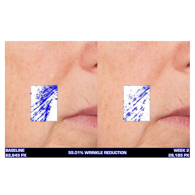 Serious Skincare Ultra-Mare Pure Marine Infusion Trio – Ultra-Mare Serum 1 oz, Ultra-Mare Facial Cream 2 oz. & Ultra-Mare Eye Cream .5 oz – Anti-Aging – Algae and Plankton extracts