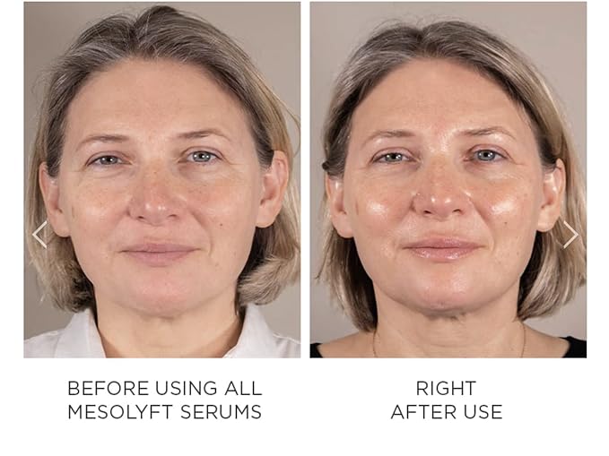 Power Combo Neck & eye Roller Brightening Face Serums for Anti-Aging Get Lip Pump's best Lip Plumper an Effectively Aging Skin Serum Multi-purpose, Eyes Neck & Décolleté Beauty Serum