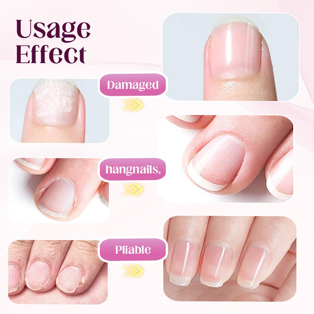 Upgrade 3-in-1 Nail Care Pen, 2025 Cuticle Pusher with Ceramic Tip for Hangnails, Dry & Damaged Nails, Nail Cuticle Remover Pens, for Moisturize Strengthen Nails (1 PC)