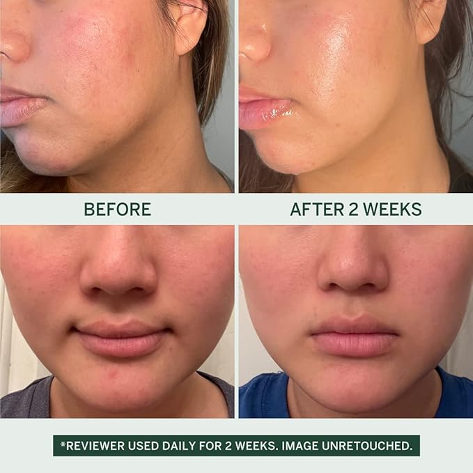 Urban Calm Collection - Fermented Skincare Bundle - for All Skin Types - Anti-Aging Skincare Set for Hydrating, Firming, Exfoliating, Soothing - With Cleanser, Essence, Serum, and Cream