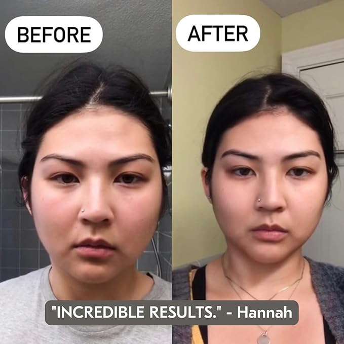 Mount Lai Rose Quartz Gua Sha Facial Tools, Pink Quartz Gua Sha Facial Tools Set and Roller, Guasha Tool for Face to Relieve Muscle Tension and Reduce Puffiness, Anti Aging Skin Care Sets for Women