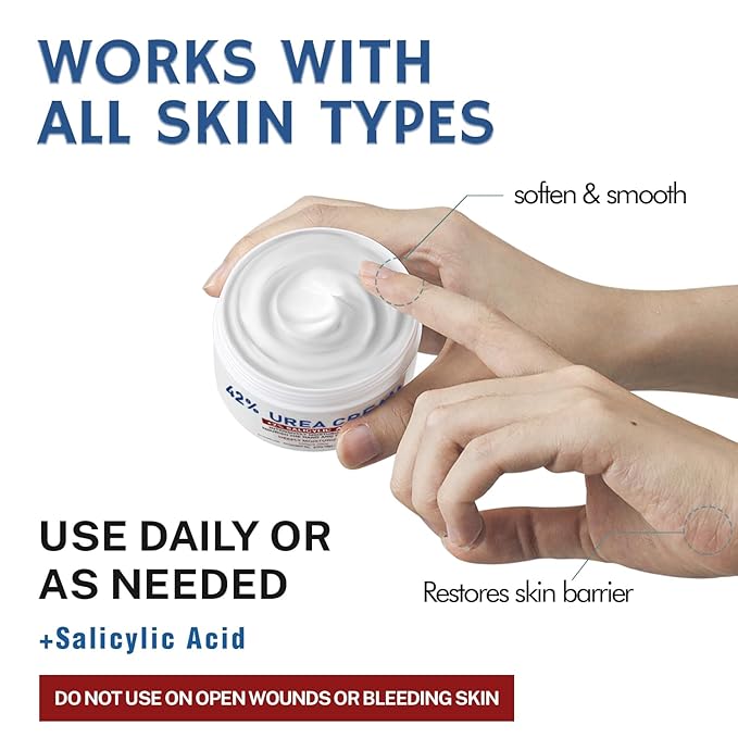 OUKEYA Urea Cream 42% plus Salicylic Acid 2% Net 5.29 Oz for Dry Cracked Feet,Heels,Knees,Elbows,Hands Repair Treatment Moisturizes and Removes Corns,Calluses,Dead Skin,and Softens Toenails
