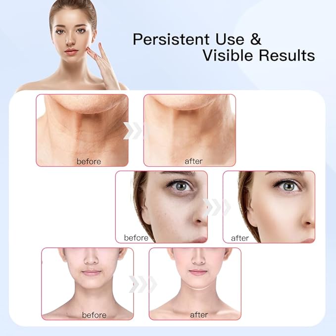 Neck Face Massager, Multifunctional Facial Massager, Face Sculpting Tool for Skin Care with Vibration, Thermal (White Gold)