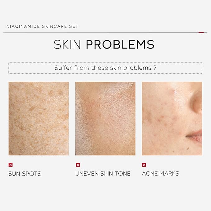 skin care set - skincare set for women - facial skin care sets & kits - gift set skincare - skin care sets for teens- skin care sets for men (ceramide)