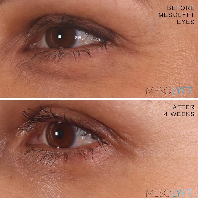 Power Combo Neck & eye Roller Brightening Face Serums for Anti-Aging Get Lip Pump's best Lip Plumper an Effectively Aging Skin Serum Multi-purpose, Eyes Neck & Décolleté Beauty Serum